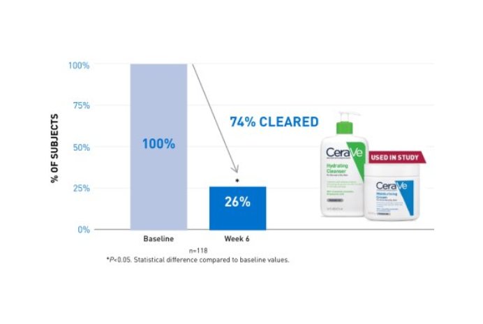 Chart showing that CeraVe Hydrating Cleanser and Moisturising Cream reduced atopic dermatitis symptoms in 74% of patients by week 6. P<0.5. Statistical difference compared to baseline values.