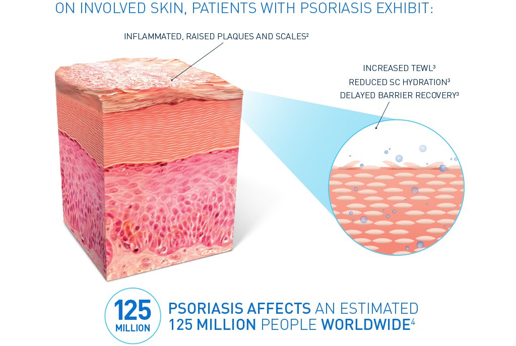 CeraVe_Psoriasis_1024x687