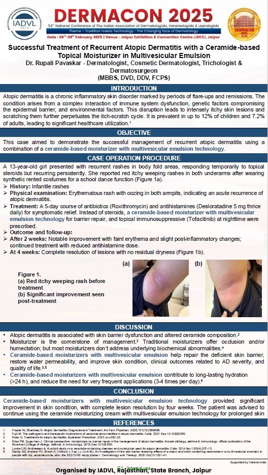 A digital survey to evaluate the self-perceived benefit of a selenium disulfide-1% salicylic acid shampoo