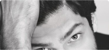 BC_HairLoss