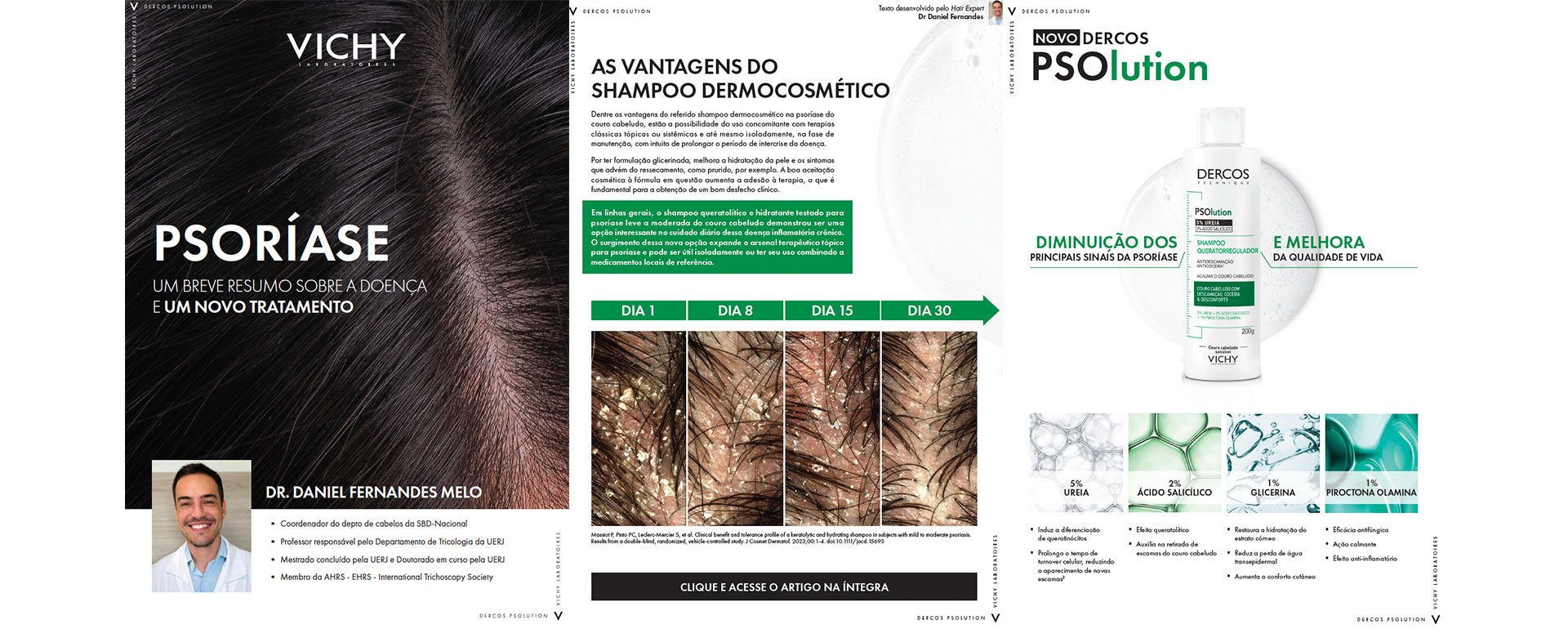 Conteúdo