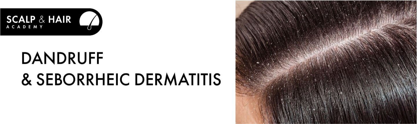 Dandruff & Seborrheic dermatitis banner