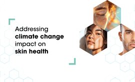 Climate change