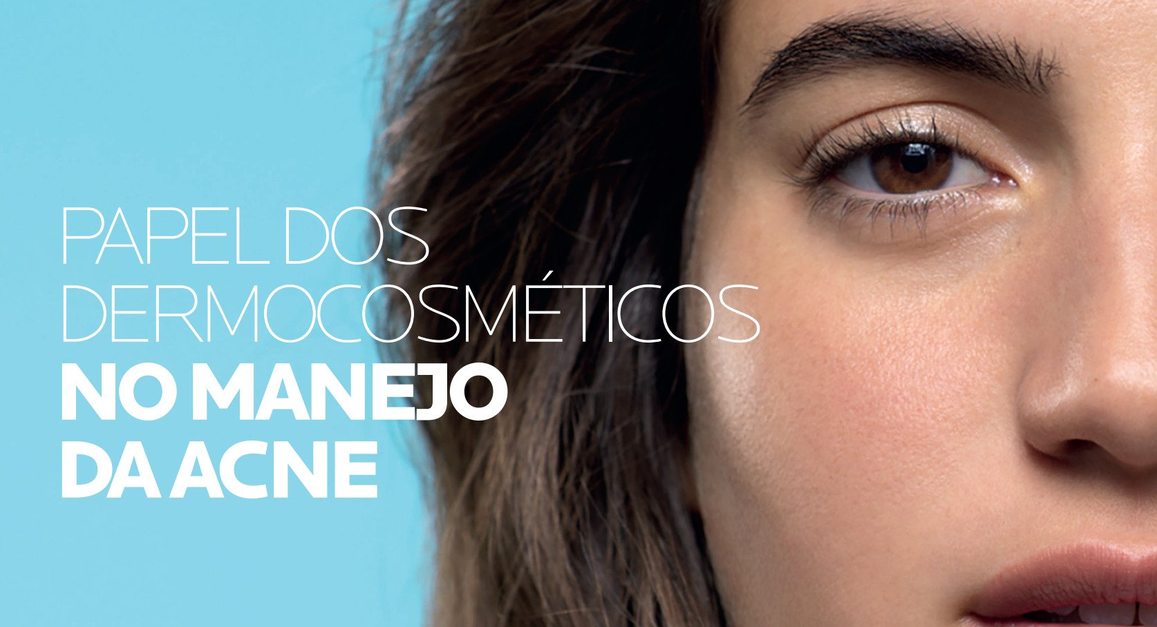 Imagem texto Papel dos dermocosméticos no manejo da acne