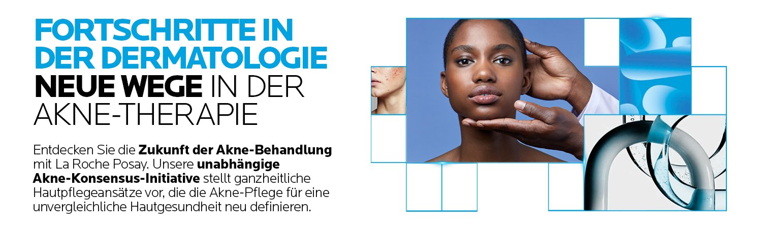 Acne consensus banner