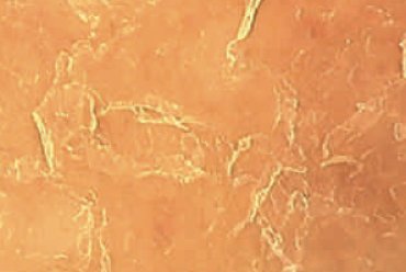 Adjunctive therapy for atopic dermatitis in daily practice