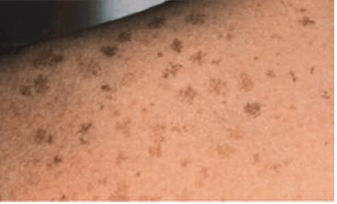 Daily care of the skin of seniors
