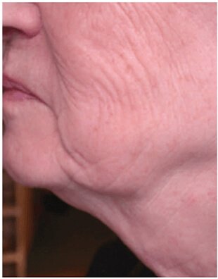 Daily care of the skin of seniors