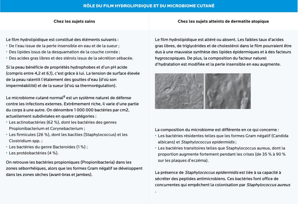 Dermocosmétiques utilisés en complément de la prise en charge de la dermatite atopique
