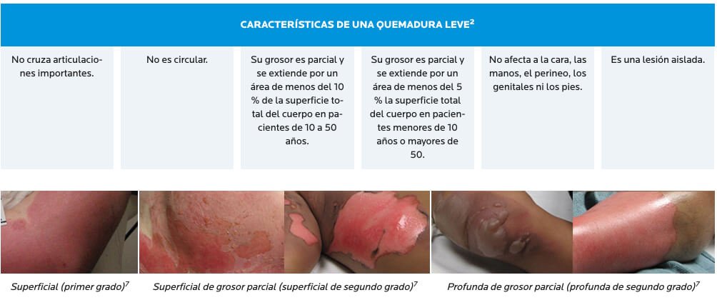 Quemaduras pueden tratarse a través del médico de cabecera