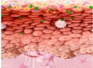 thumbnail ALLERGY MICROBIOME
