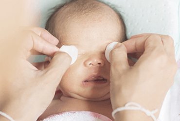 Newborn skin: proper care