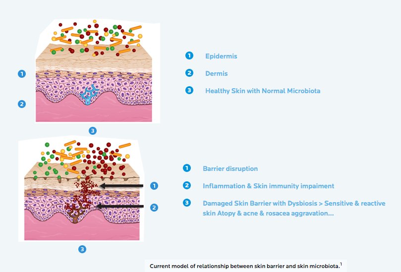 Protecting the balance of skin microbiota is essential for maintaining an effective skin barrier an evidence review