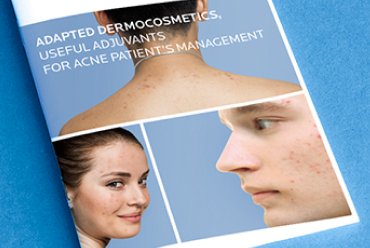 Adapted Dermocosmetics, Useful Adjuvants for Acne Patient’s Management