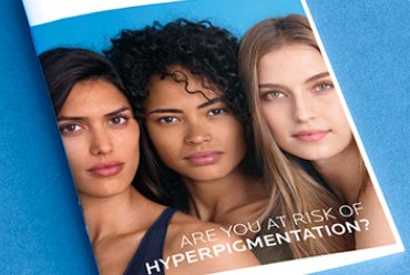 Are you at risk of hyperpigmentation?
