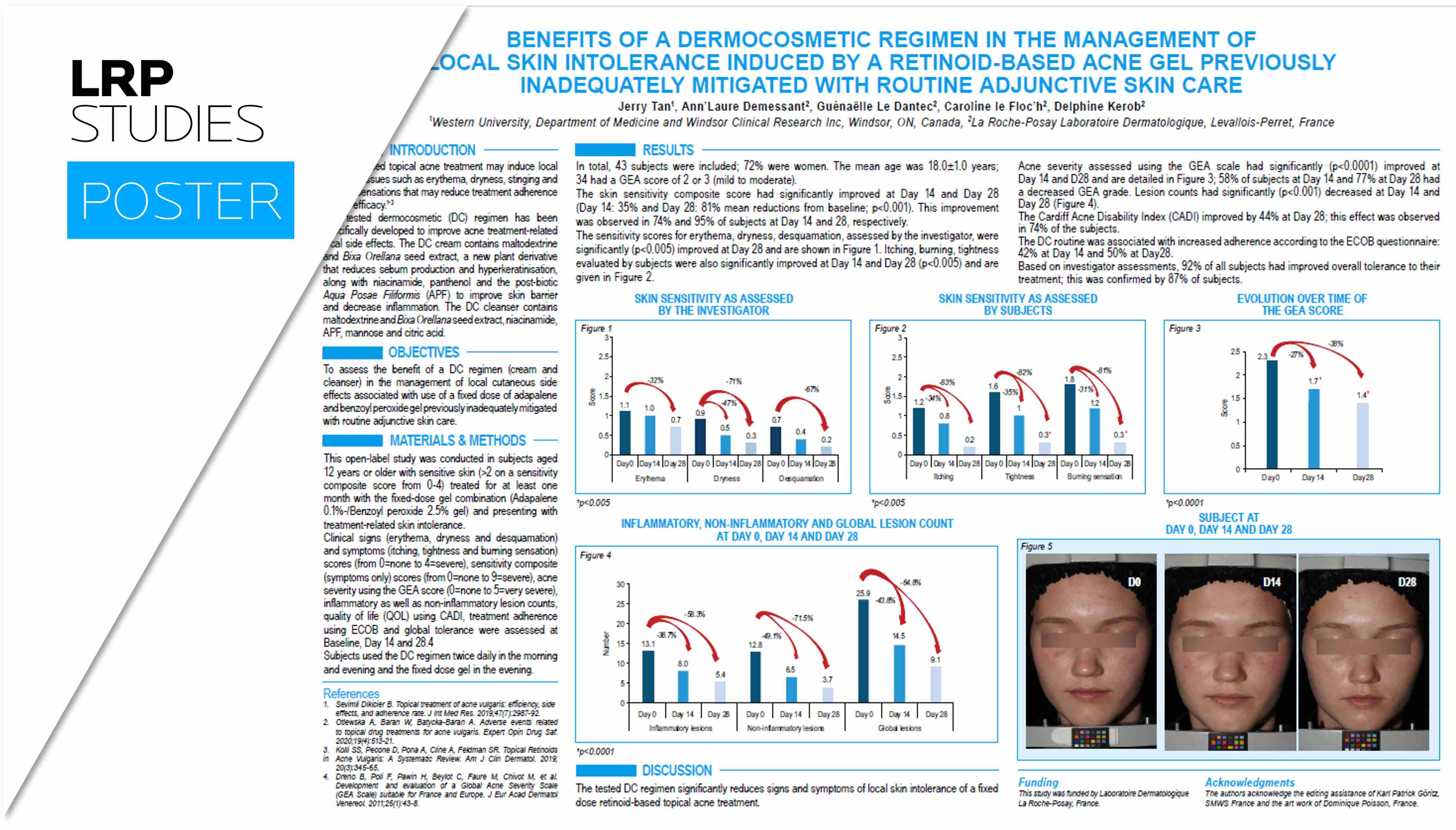 Adult female acne infography
