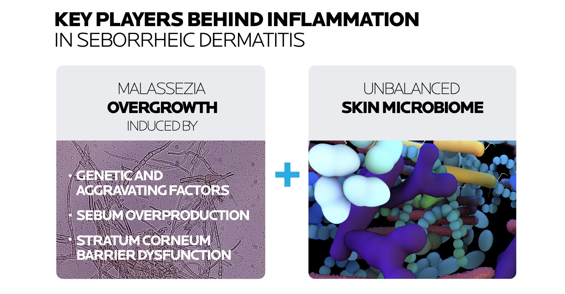 Seborrheic dermatitis chronic skin inflammation