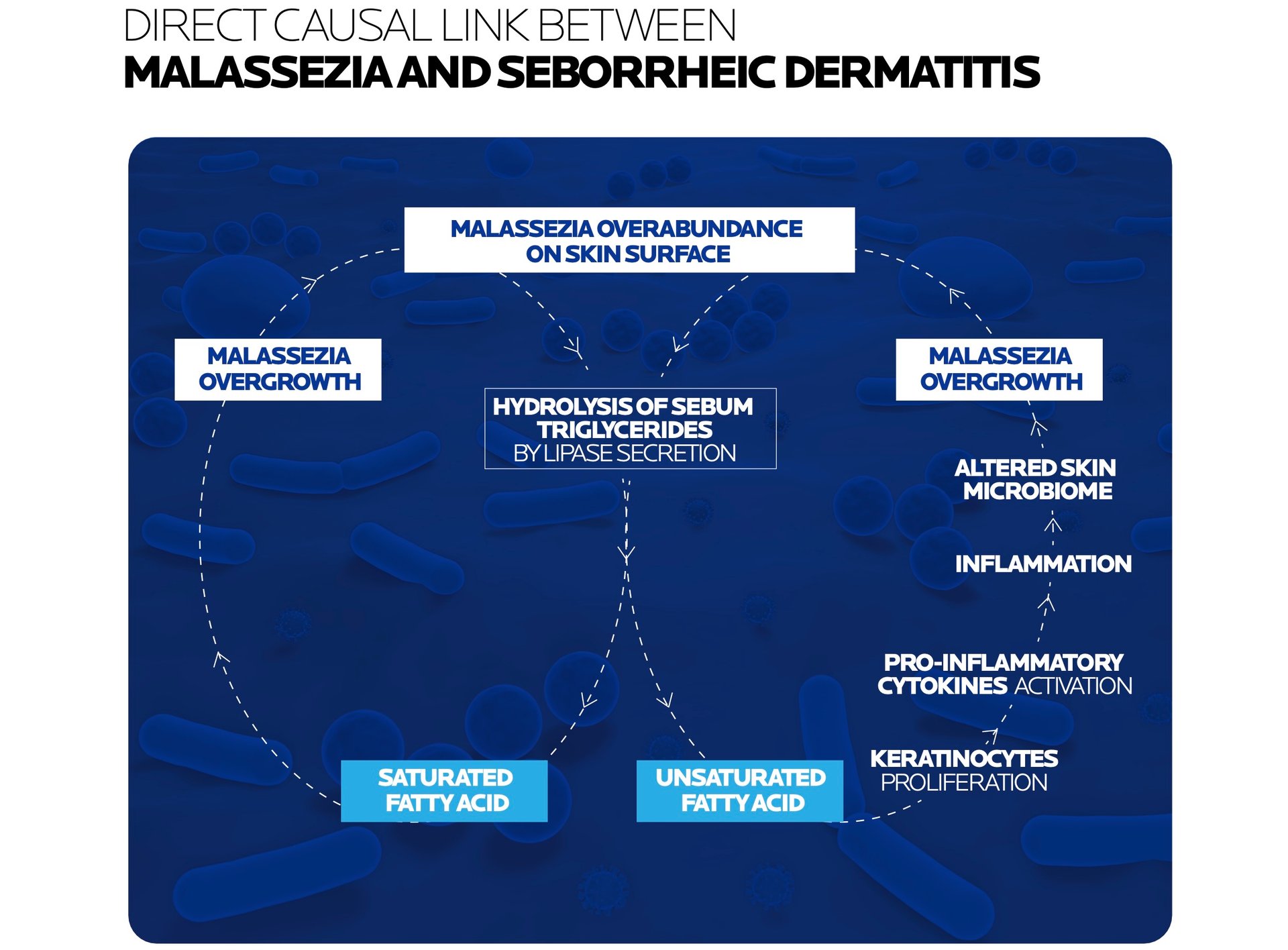 Seborrheic dermatitis chronic skin inflammation