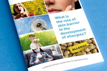 What is the role of skin barrier in the development of allergies?