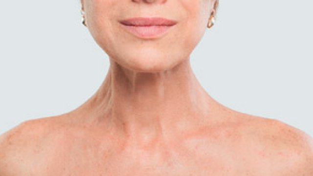 Dermacademy Challenge – Clinical Case #1 – Pr. Marie-Sylvie Doutre