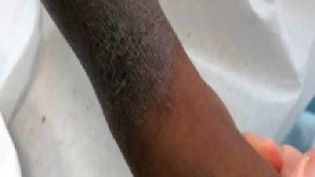 Dermacademy Challenge – Case # 2 – Pr. Gelmetti