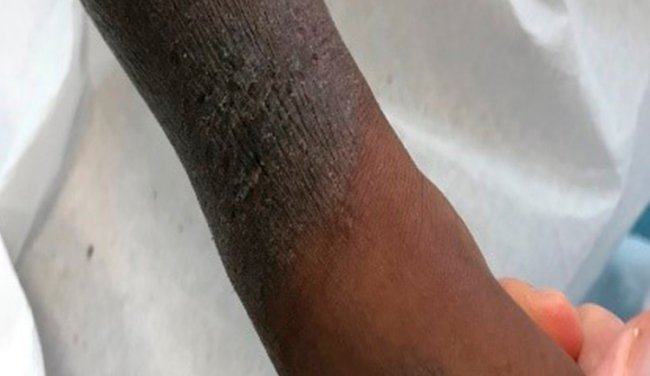 Dermacademy Challenge - Clinical Case #2 - Prof. Gelmetti
