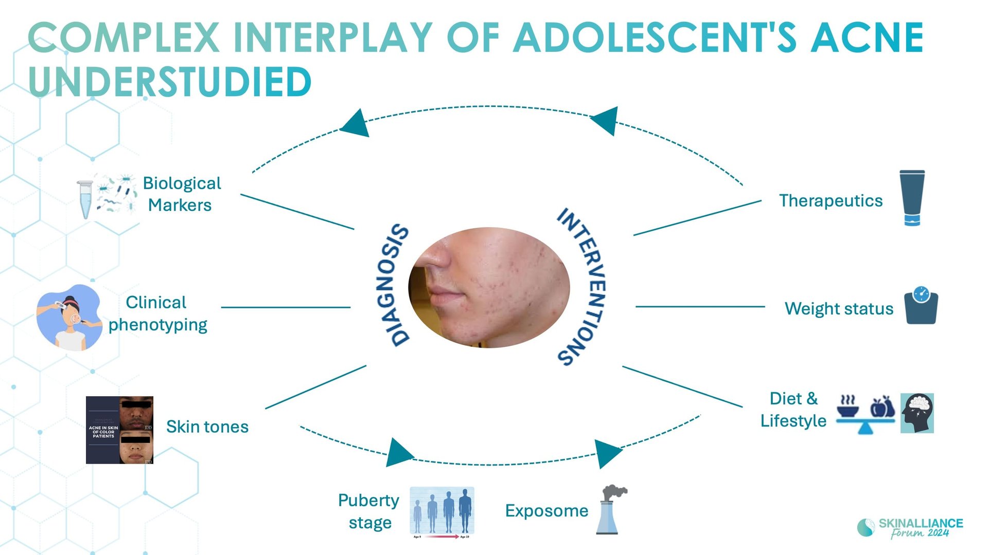  Prevalence and occurrence of acne in adolescents