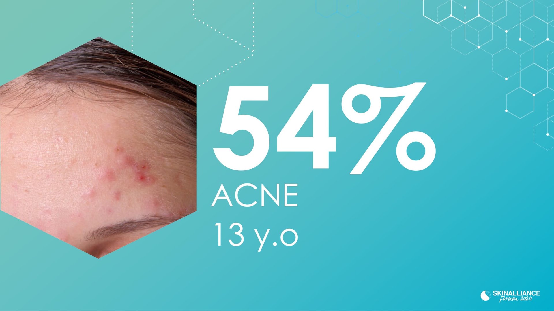 Prevalence and occurrence of acne in adolescents