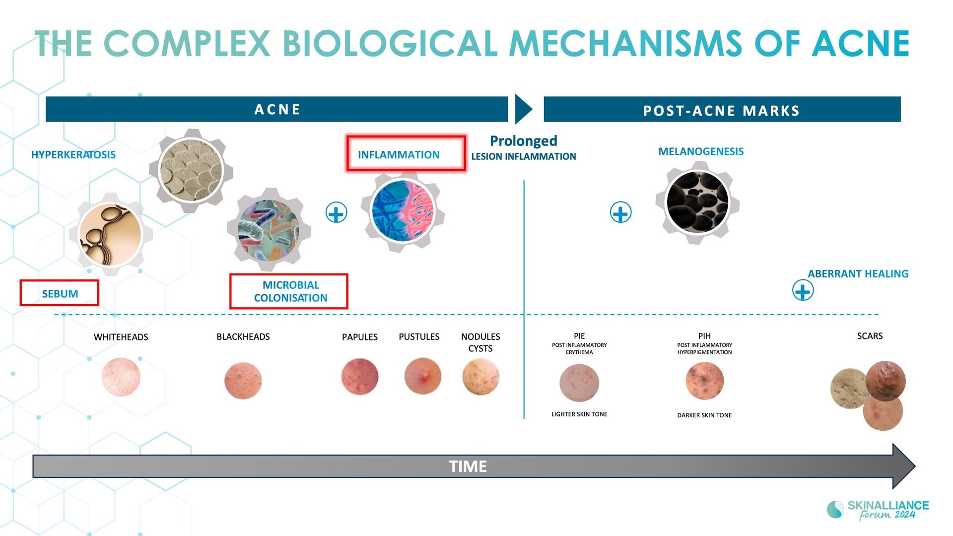 Biological events during various stages of acne
