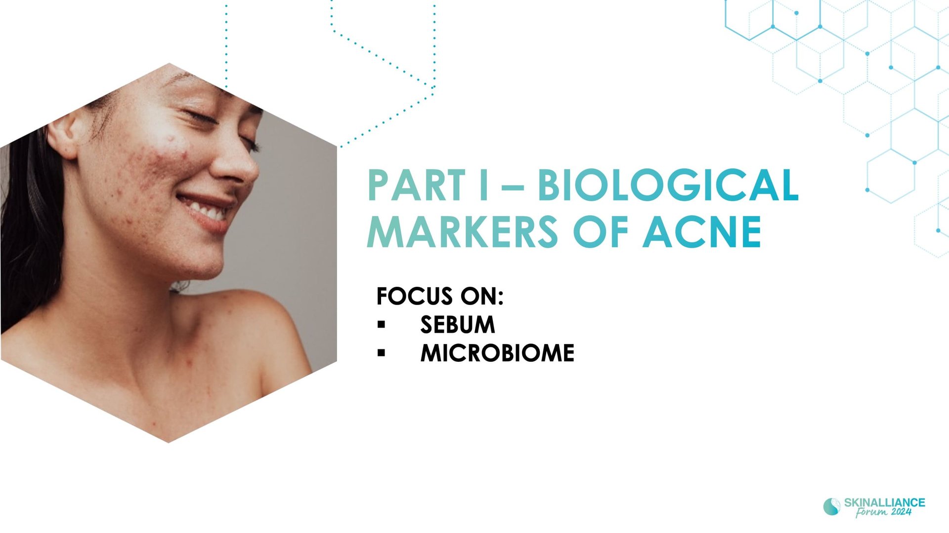 Biological events during various stages of acne
