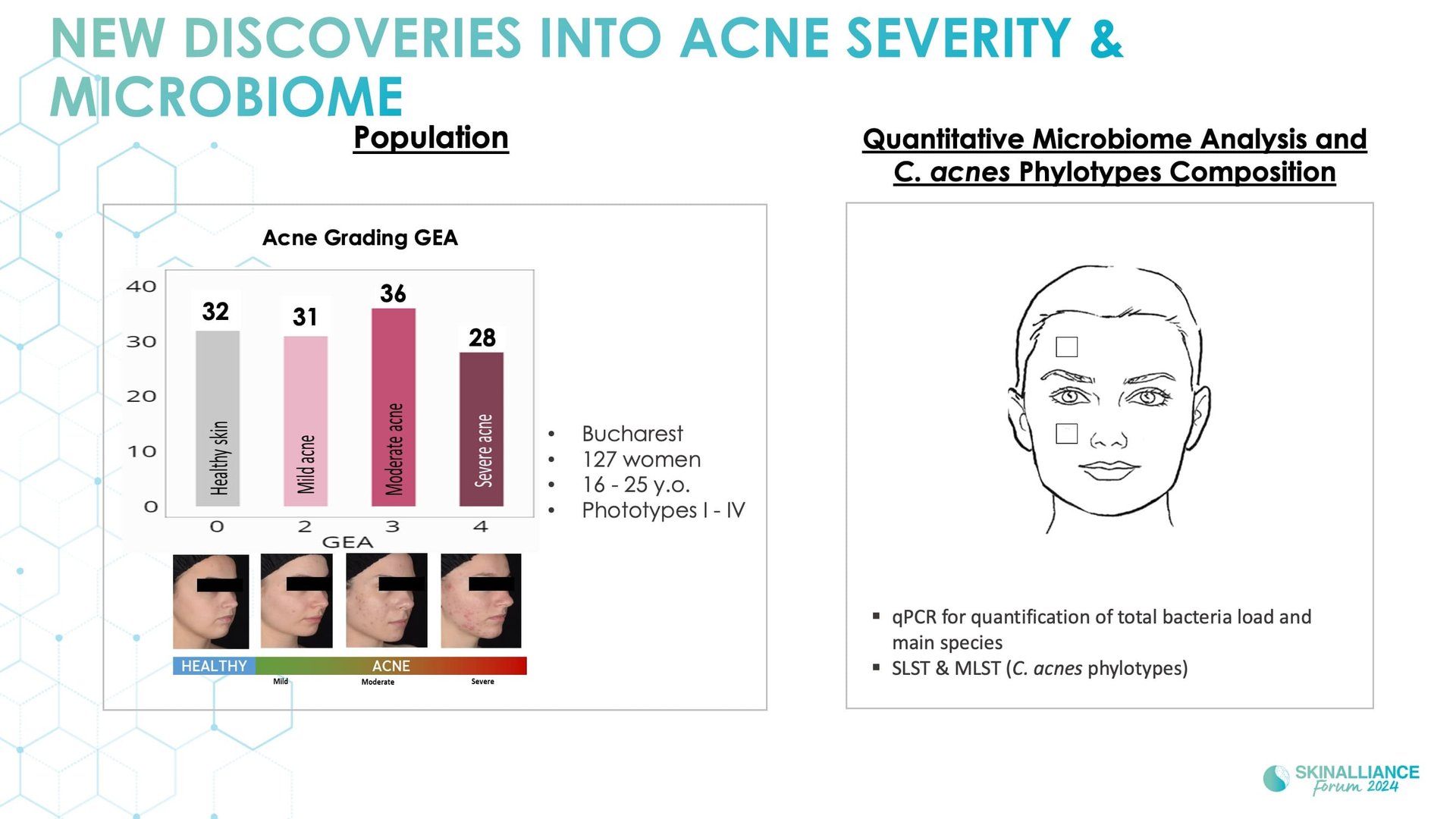Biological events during various stages of acne