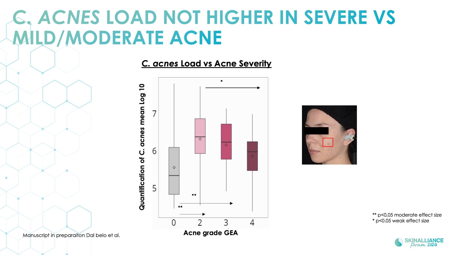 Biological events during various stages of acne