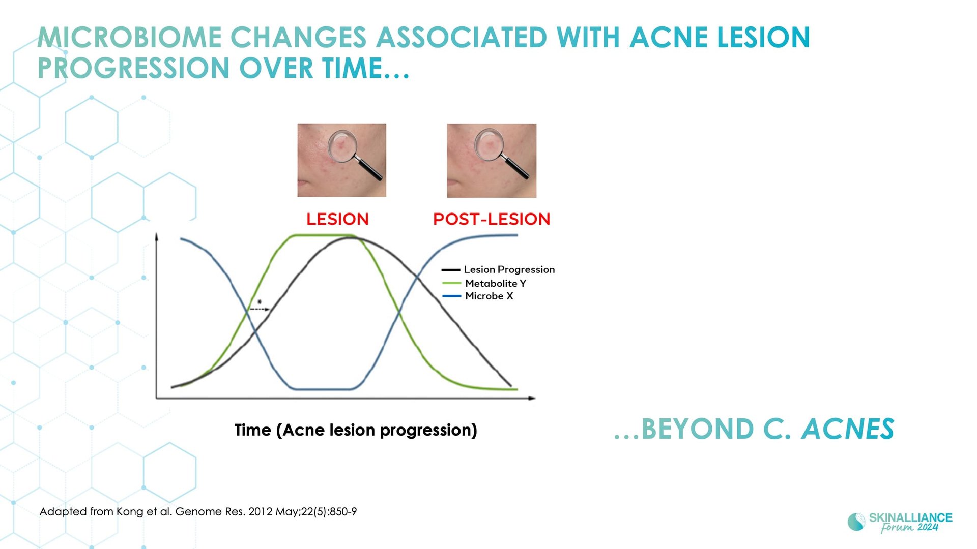 Biological events during various stages of acne