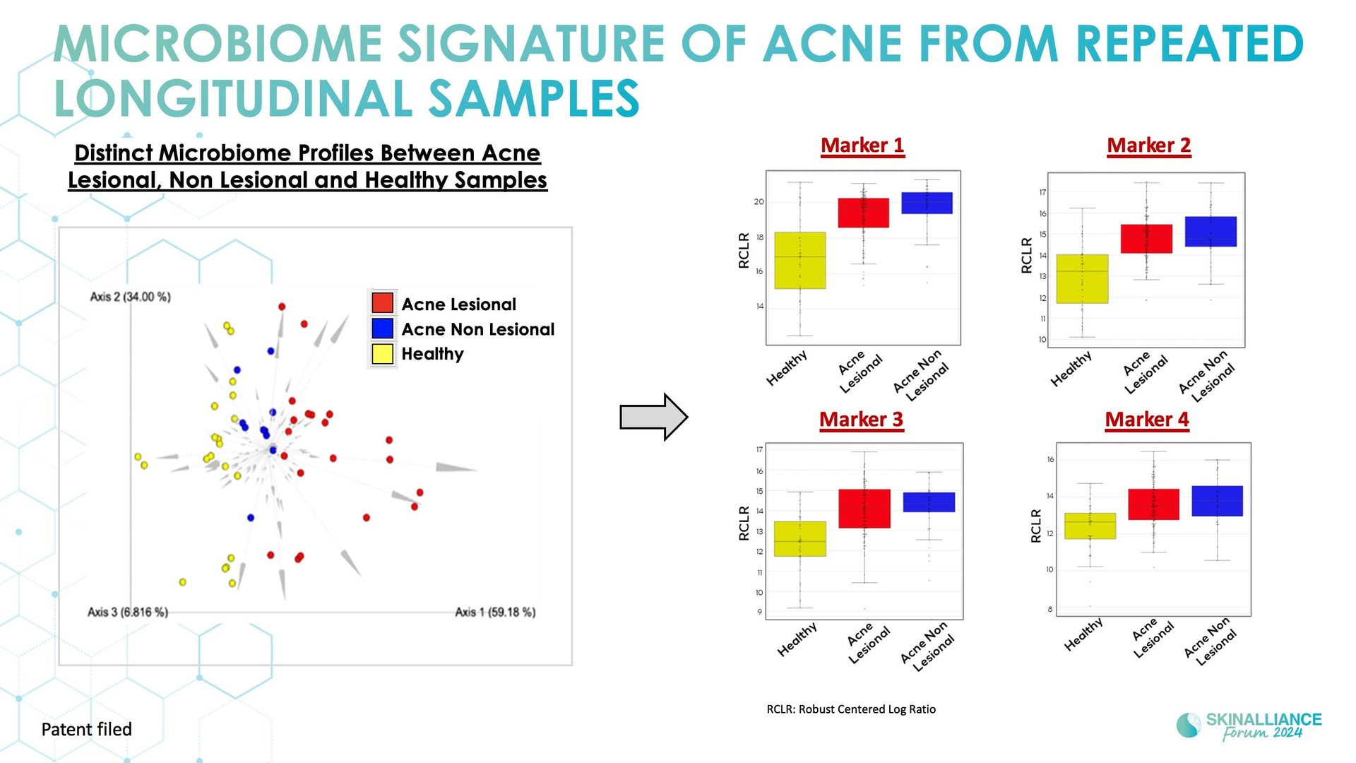 Biological events during various stages of acne