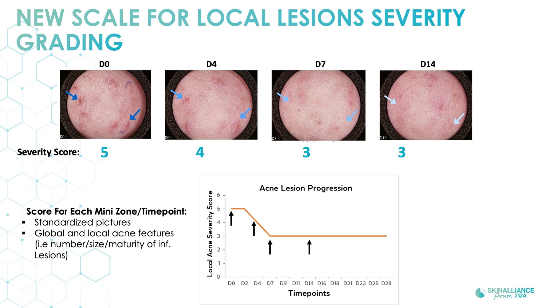 Biological events during various stages of acne