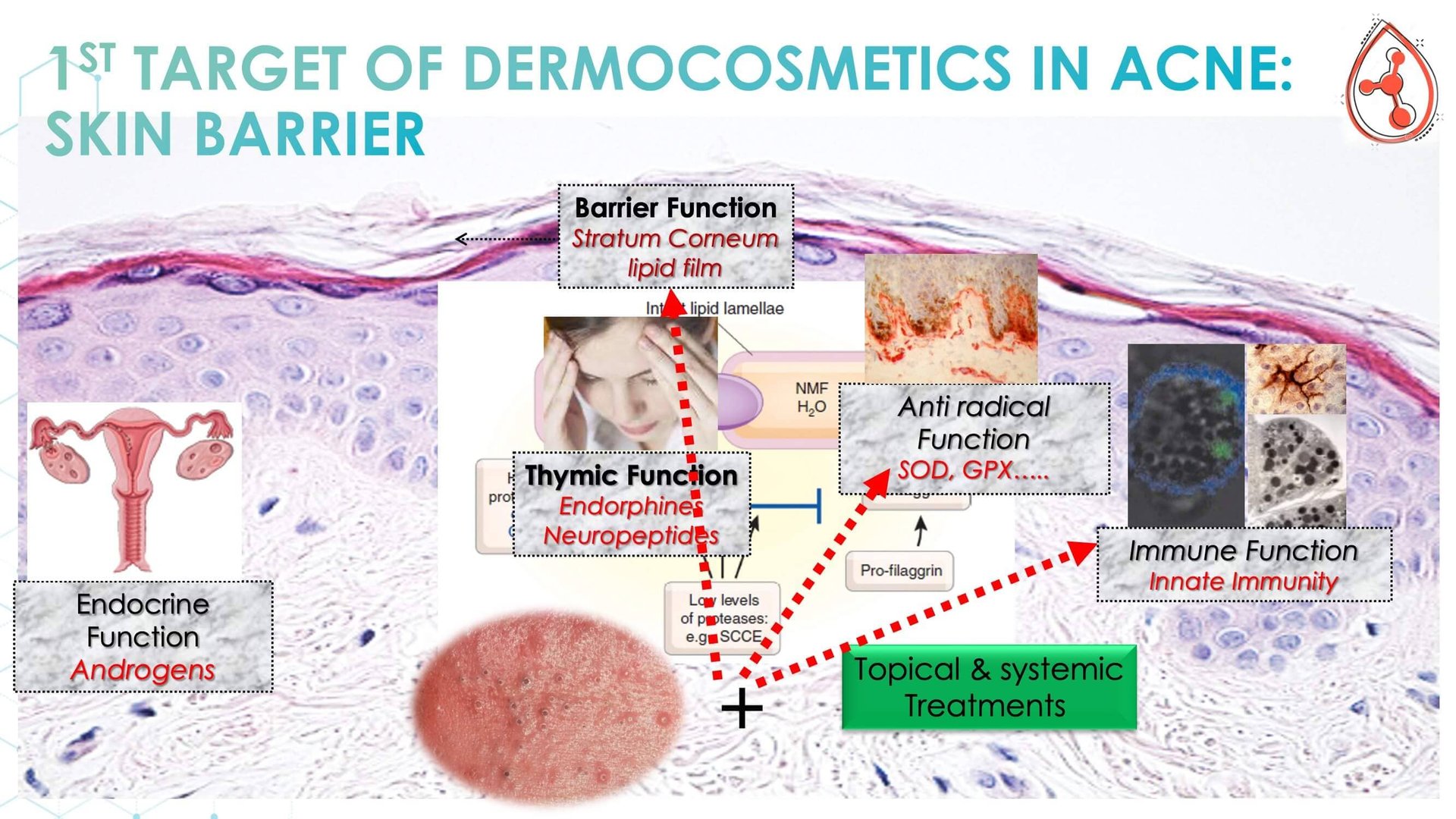Acne and the role of dermocosmetics
