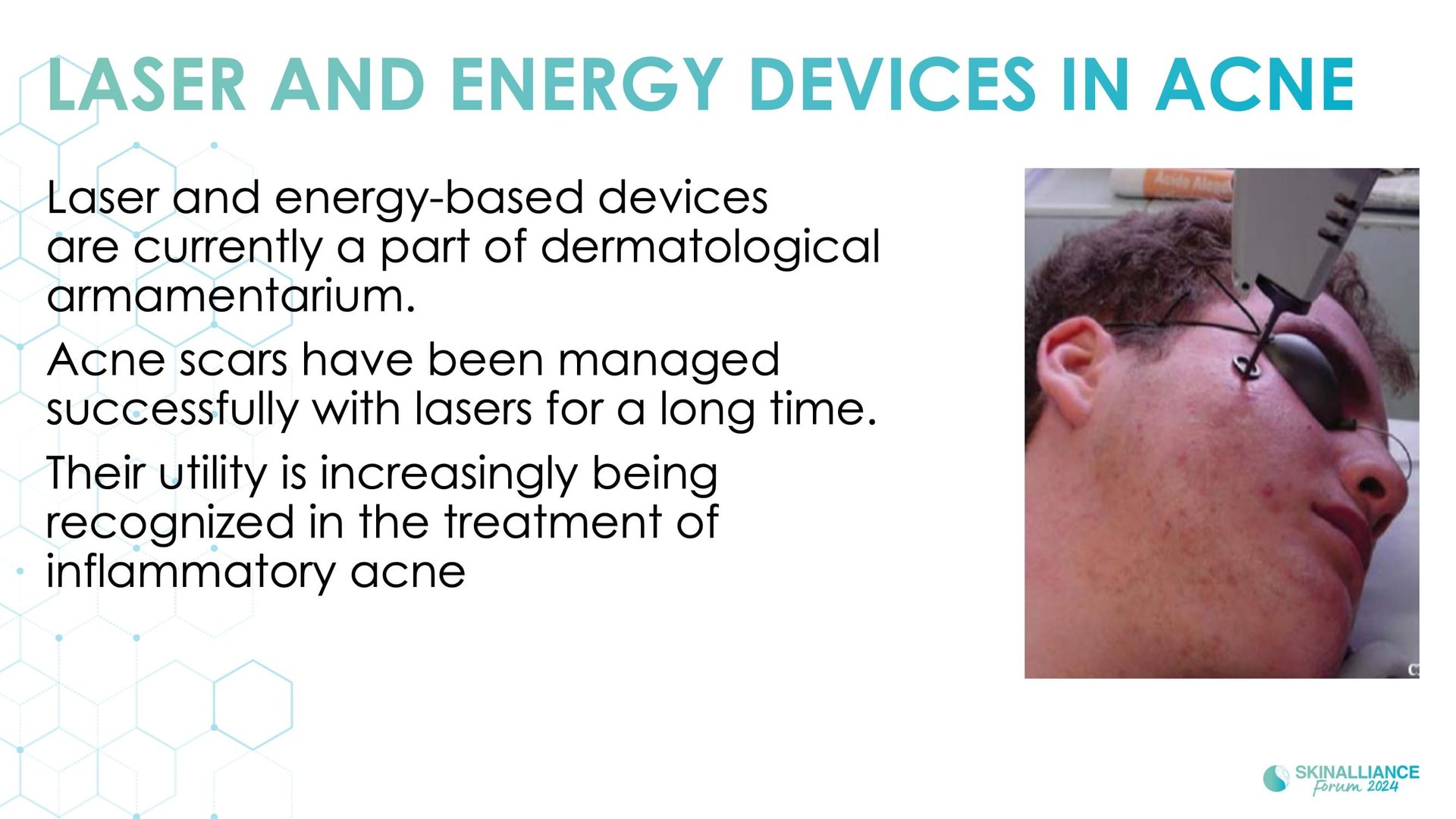 New devis treatments in acne
