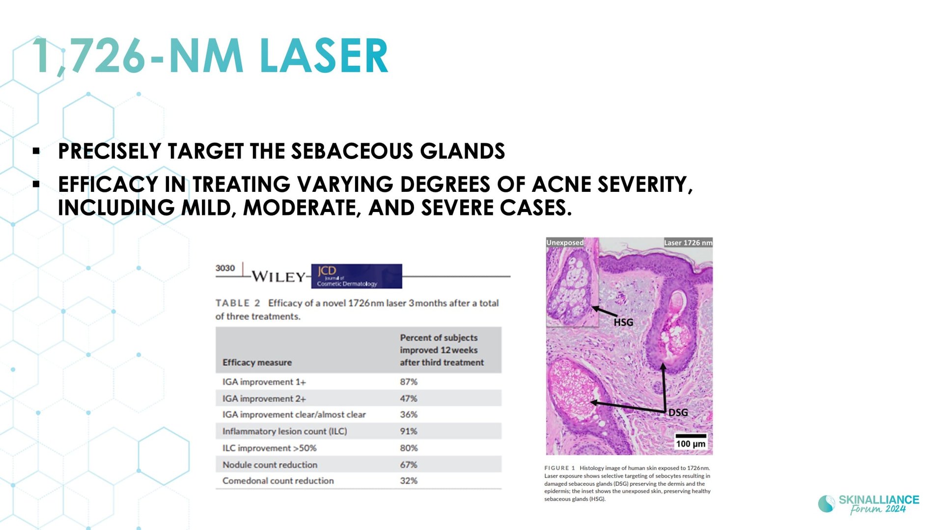 New devis treatments in acne