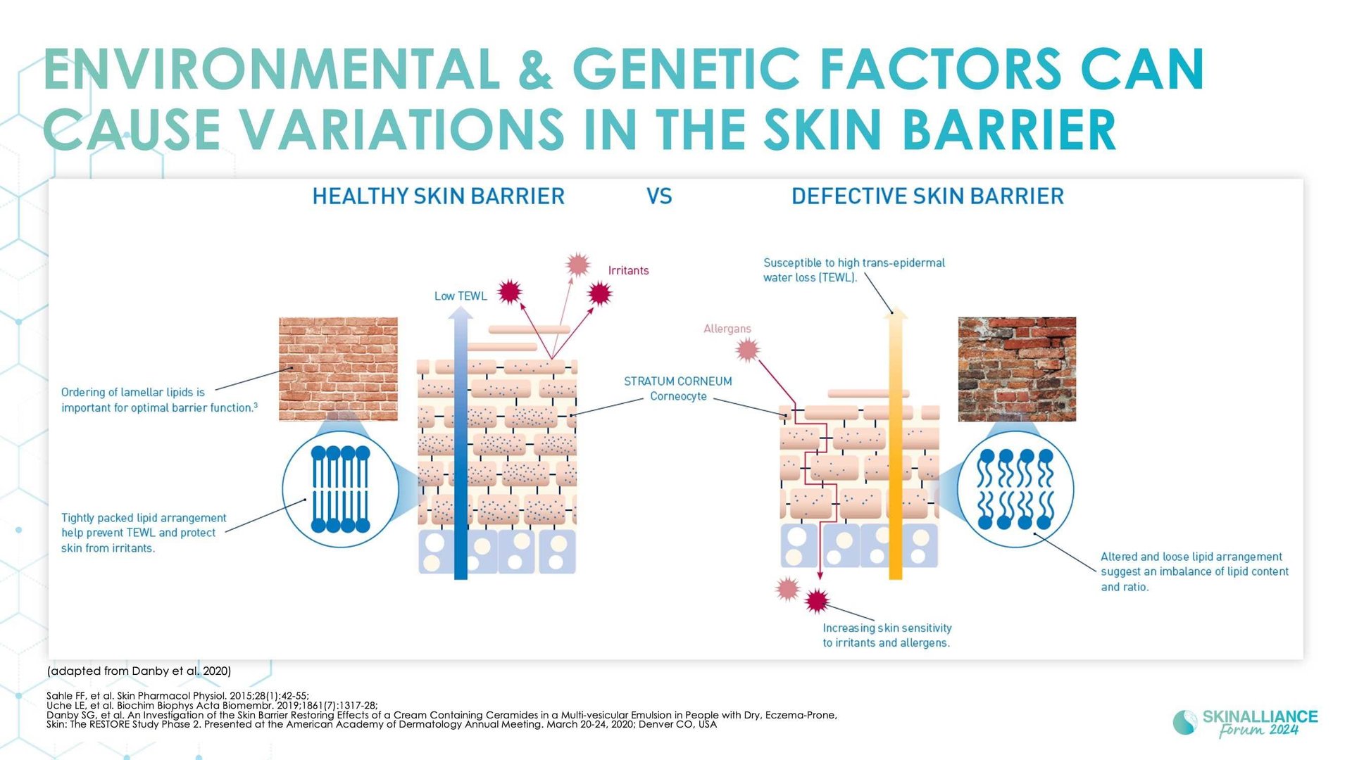 Racial/ethnic variations in skin barrier structure, function, and composition in dry, atopic skin
