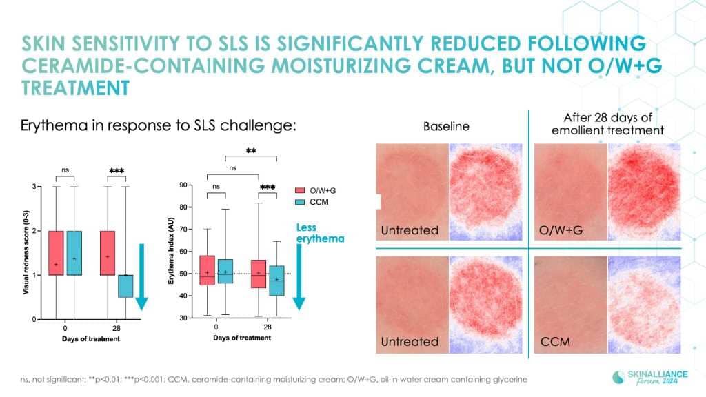 Advanced methods for evaluating emollients: the brace study