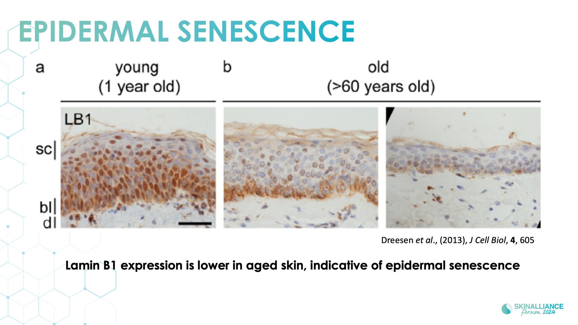 Regenerative/Cellular Senescence