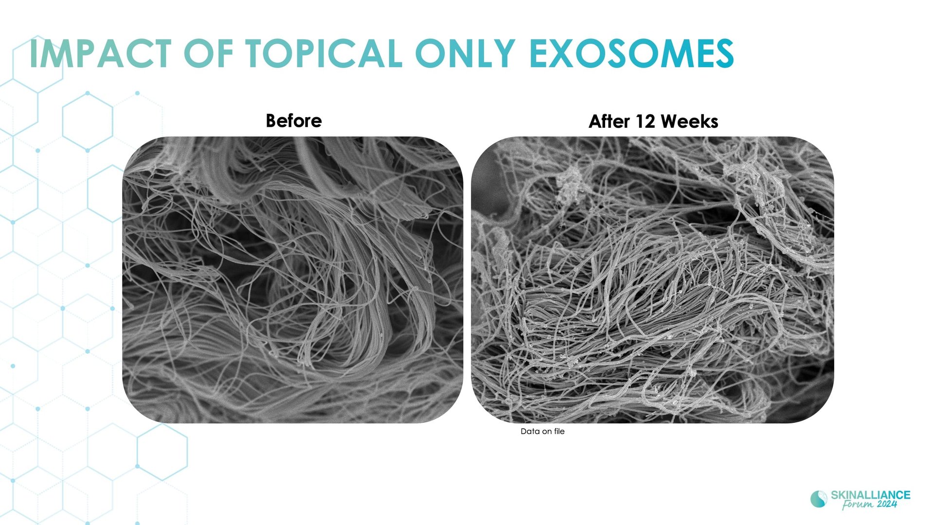 Exosomes and skin longevity