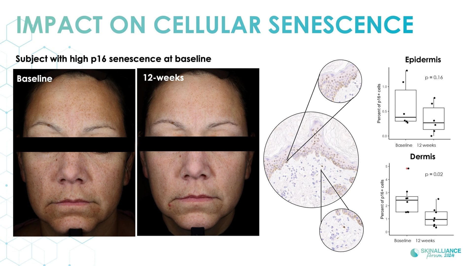 Exosomes and skin longevity