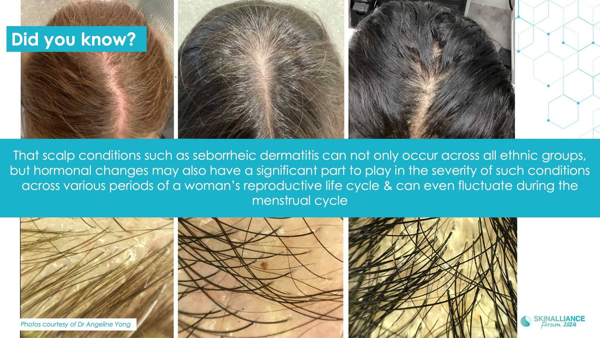 Innovating in hair research and topical solutions