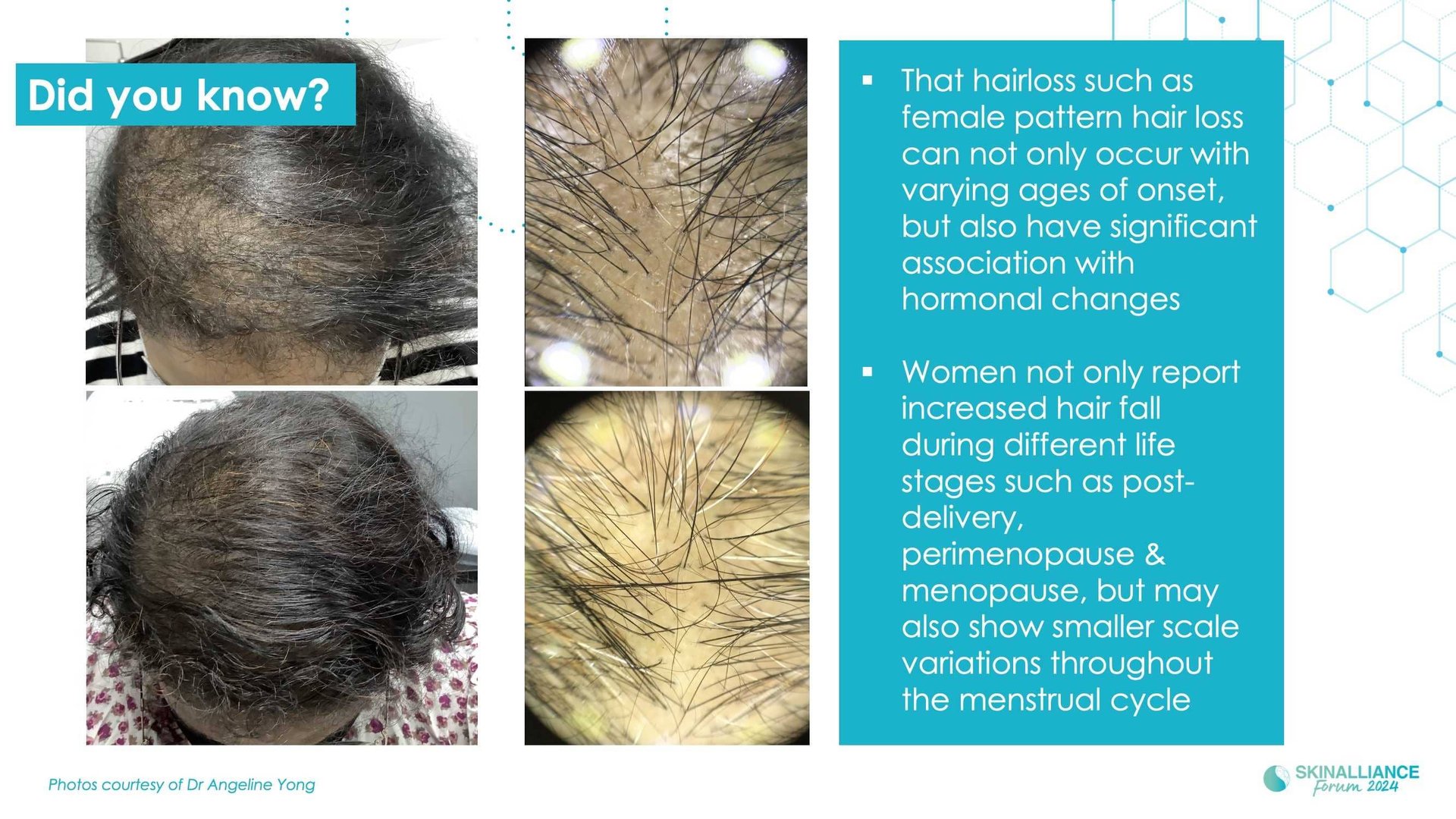 Innovating in hair research and topical solutions