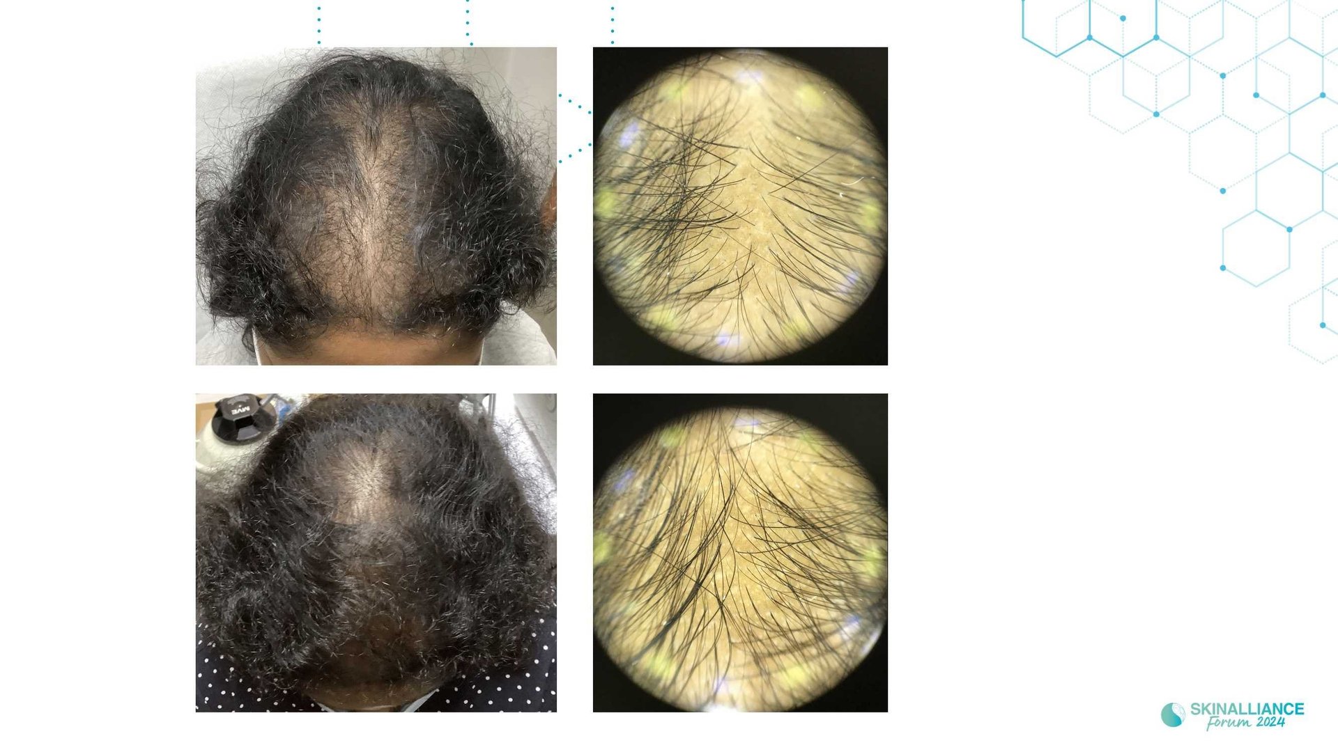 Innovating in hair research and topical solutions