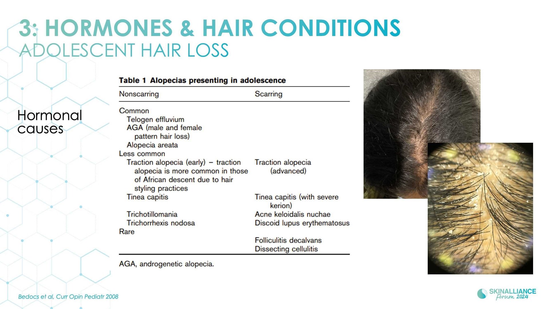 Innovating in hair research and topical solutions