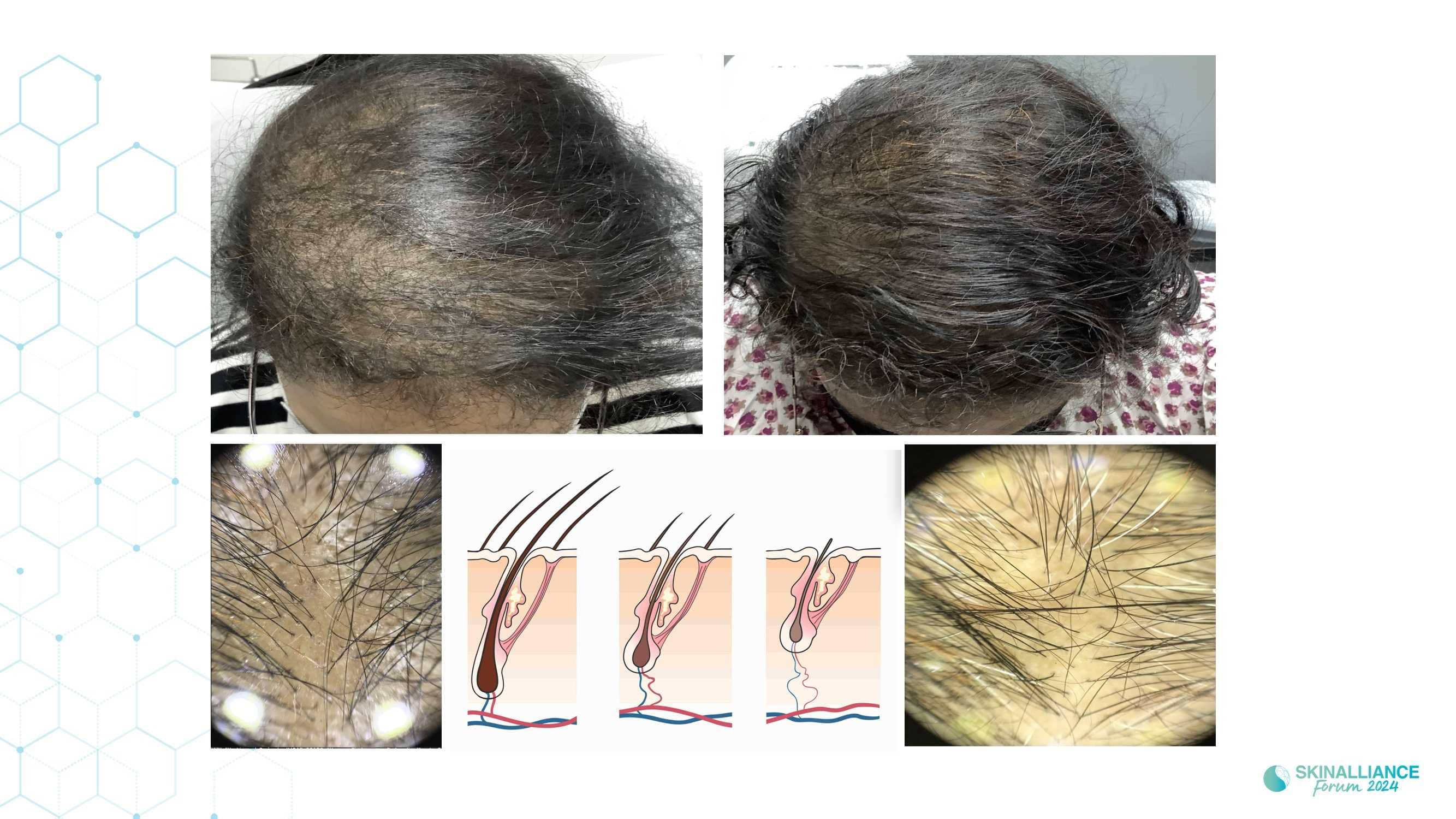 Innovating in hair research and topical solutions