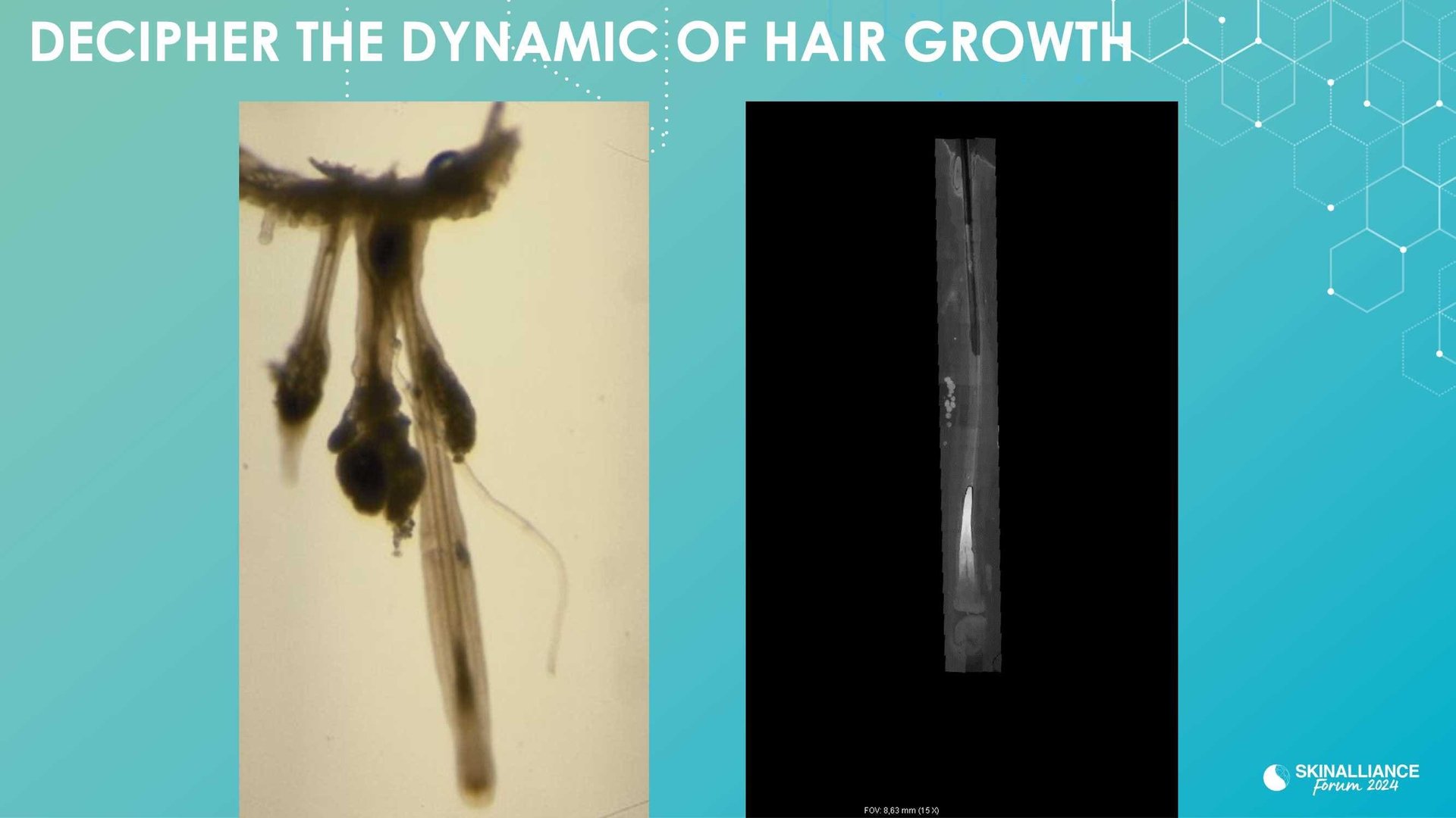 New research evidence in hair loss