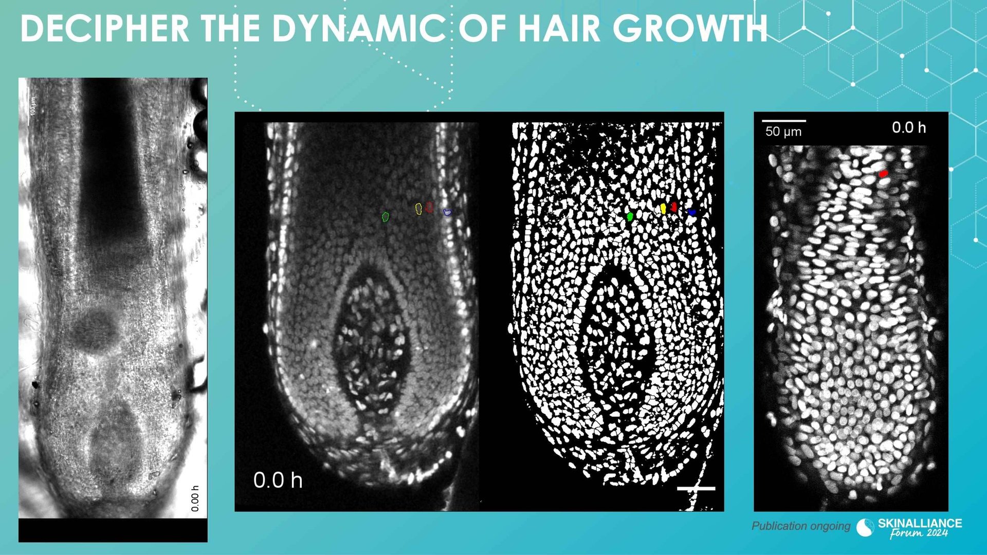 New research evidence in hair loss